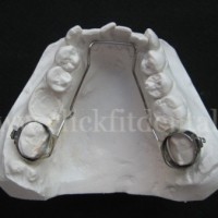 Lingual Arch is used to maintain mandibular molar anchorage, arch width and length.
